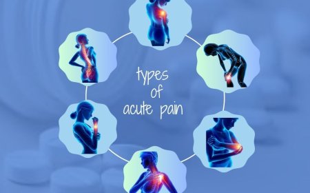 How Can I Relieve Acute Pain Quickly?