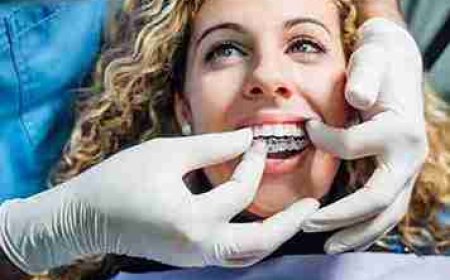 Smile Brighter: How Food Plays a Role in Teeth Whitening