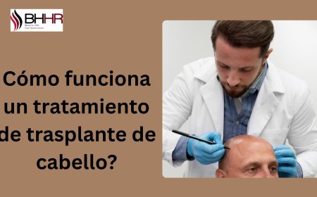Cómo funciona un tratamiento de trasplante de cabello?