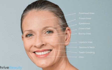 Discover the Benefits of Botox in My Area for a Refreshed Look