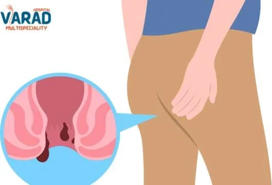 Piles Doctor in Pune – Get Safe, Lasting Relief from Hemorrhoids