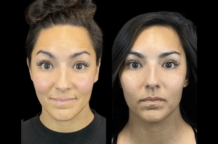 The Best Aesthetic Clinic in Dubai for Anti-Aging Solutions: What Sets It Apart