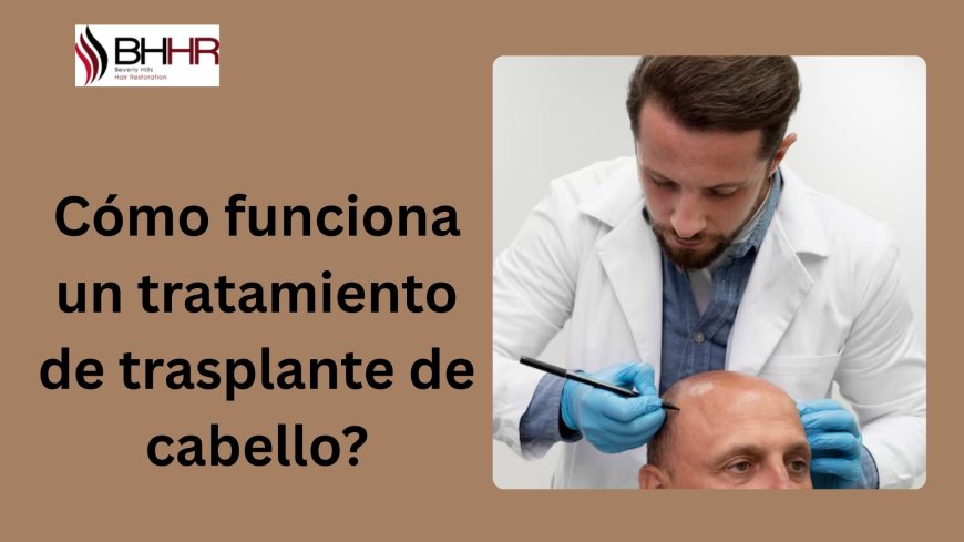 Cómo funciona un tratamiento de trasplante de cabello?