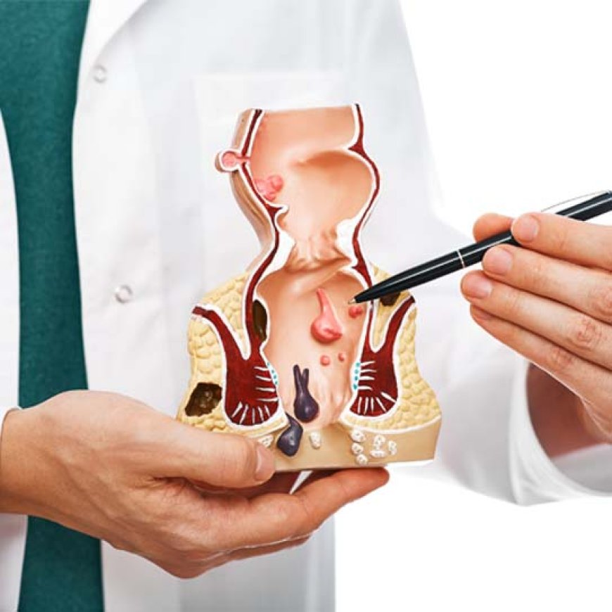 Piles Doctor Mumbai: Your Ultimate Guide to Hemorrhoid Treatment and Care