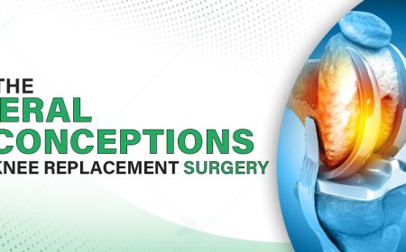 Know the General Misconceptions about Knee Replacement Surgery