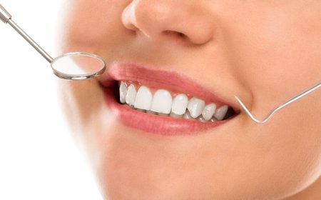 Trusted Dental Specialist in Panchkula for Root Canals and Teeth Whitening