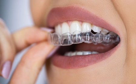 Achieve a Straighter Smile with Invisalign: The Clear Choice in Palmdale