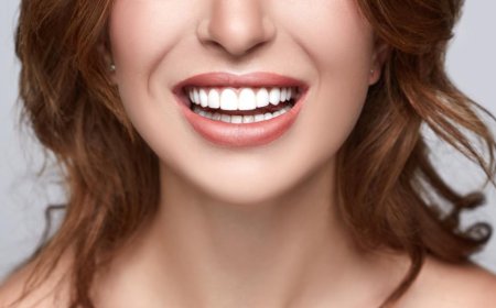 Transform Your Smile with Confidence: A Complete Guide to Veneers in Encino