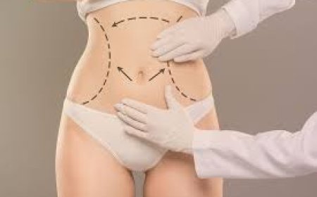 Understanding Scarring After Abdominoplasty Dubai Procedures