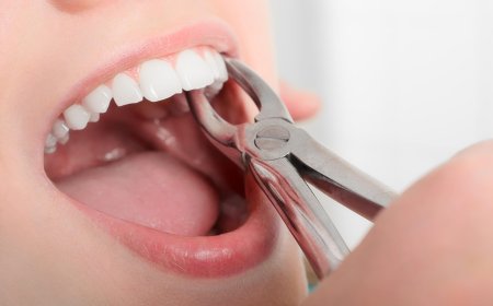 Preparing for a Tooth Extraction: What to Expect at Diablo Oral Surgery