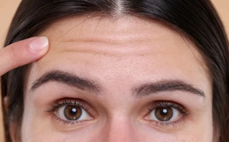 Stirnfalten: Ursachen, Behandlungen und Tipps zur Vorbeugung