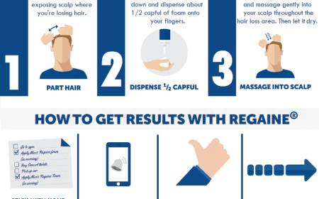 How Long Does Minoxidil Foam Take to Work and Why Aussies Are Choosing It for Hair Growth