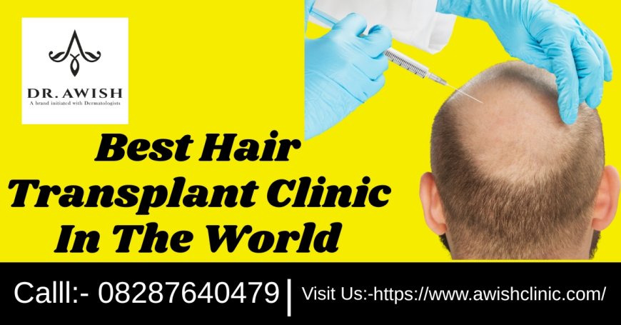 Transform Your Look Best Hair Transplant Clinic in the World with Proven Results