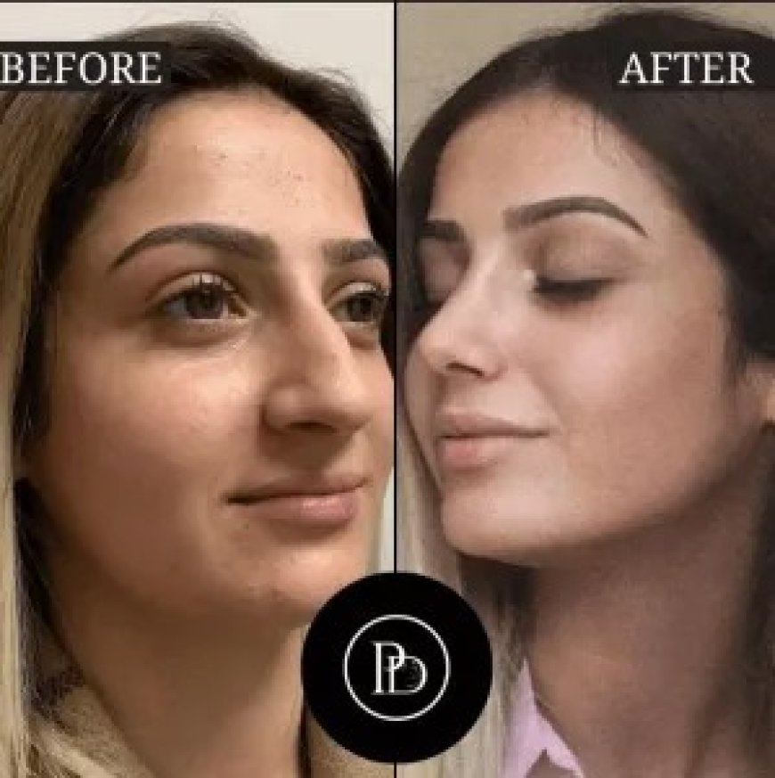 Dubai’s Best Plastic Surgeons for Natural-Looking Results
