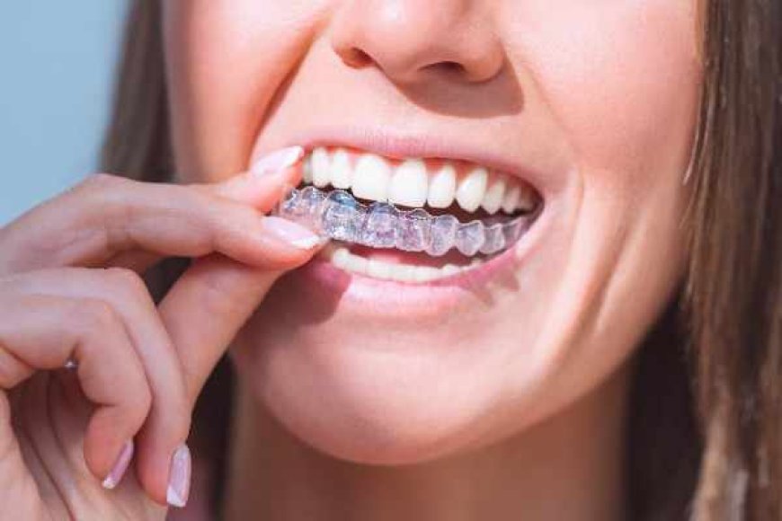 How to Clean Invisalign Why It’s Important and How to Do It