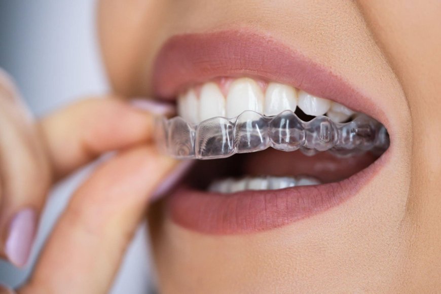 Achieve a Straighter Smile with Invisalign: The Clear Choice in Palmdale