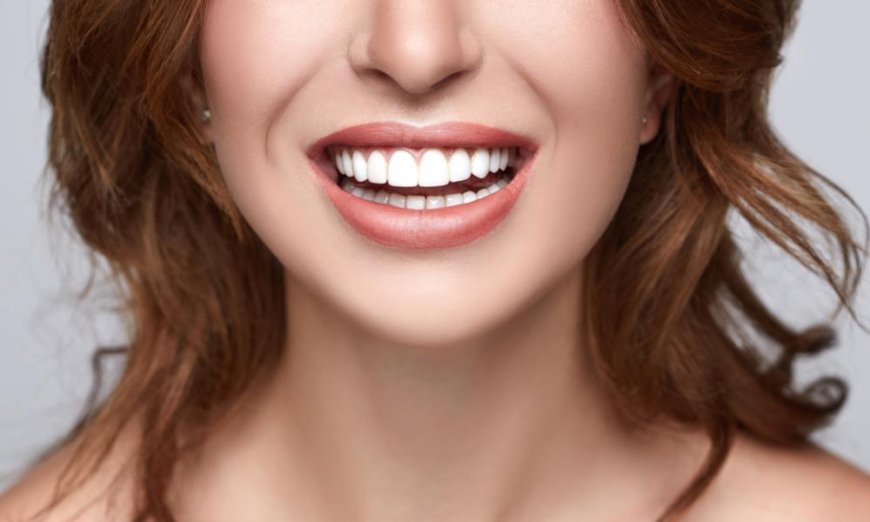 Transform Your Smile with Confidence: A Complete Guide to Veneers in Encino