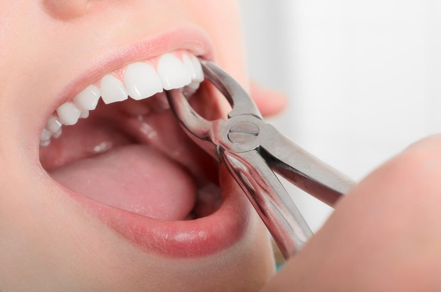 Preparing for a Tooth Extraction: What to Expect at Diablo Oral Surgery
