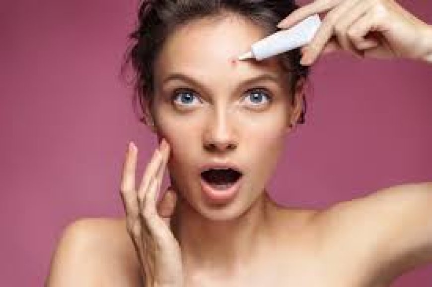 Tretiva 40 mg: The Strong Solution for Severe Acne